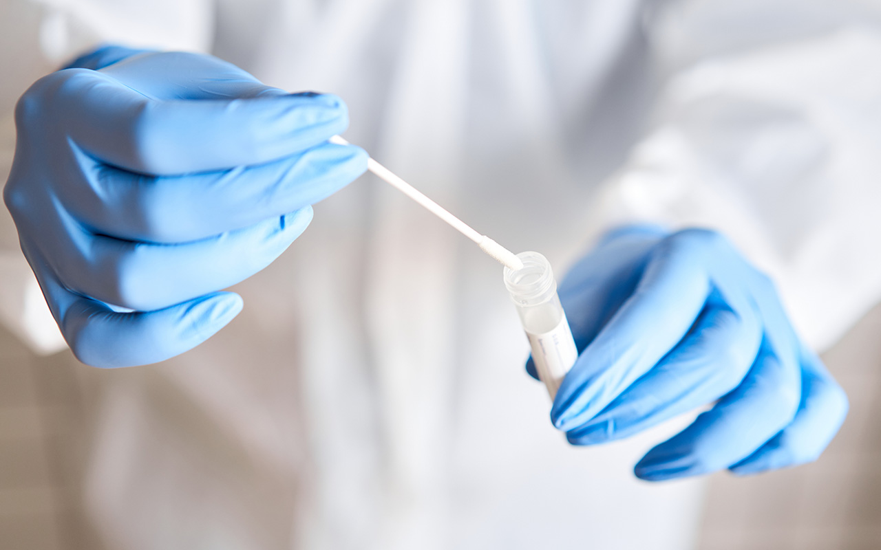Swab Tube Kit for Viral Testing